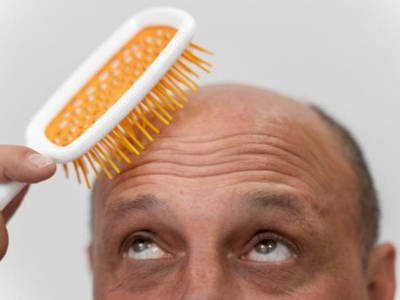 Haarausfall– was zu tun ist und was besser nicht